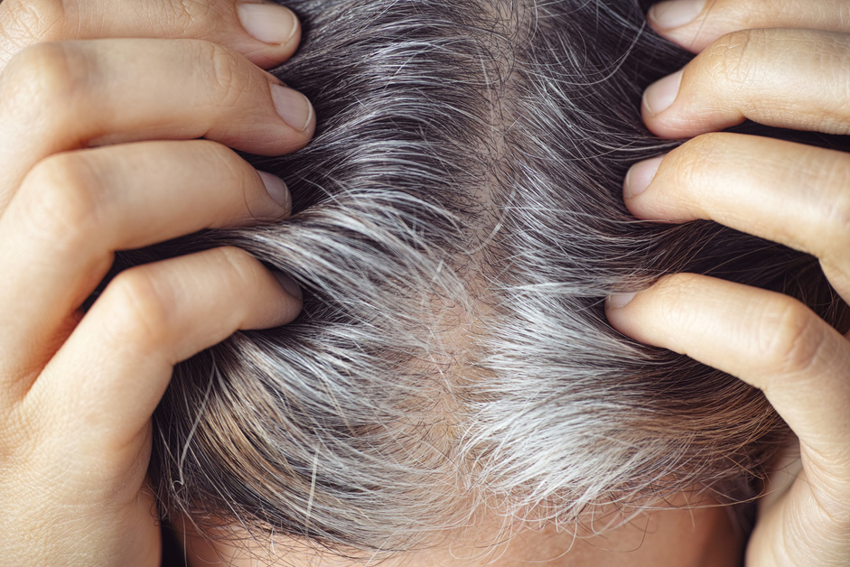 A woman showing her gray hair roots. Going gray concept.